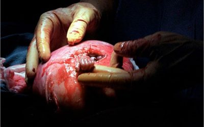 قصة " يد الأمل "